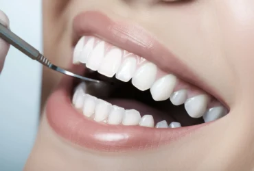 denti-sbiancamento-centri-dentistici-primo