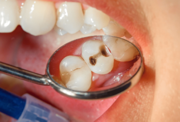 Cesmed-medica-odontoiatria-conservativa