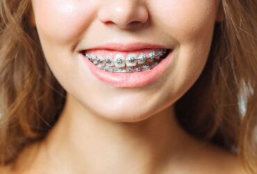 DM_il-dentista-moderno_momento-auxologico-in-ortodonzia