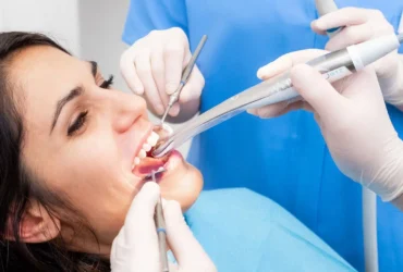Francesca-chirurgia-orale