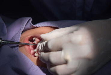 chirurgia-orale-1