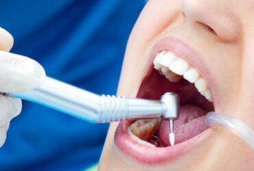 chirurgia-orale (2)